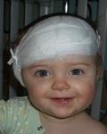 Smiling baby with a bandage over her head and ear